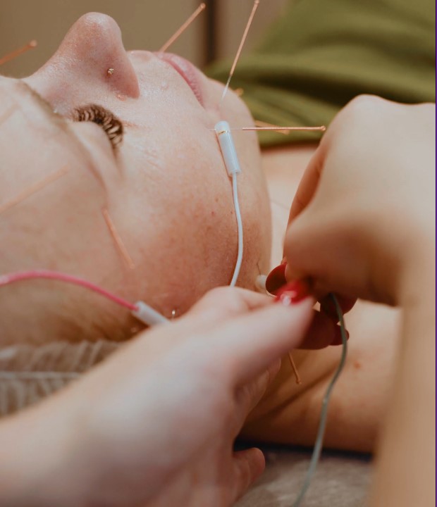 Podłączenie mikroprądów — elektrody przy igłach podczas neuroliftingu
